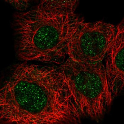 Immunocytochemistry/Immunofluorescence: Rad50 Antibody [NBP2-47316] - Immunofluorescent staining of human cell line A-431 shows localization to nucleoplasm.