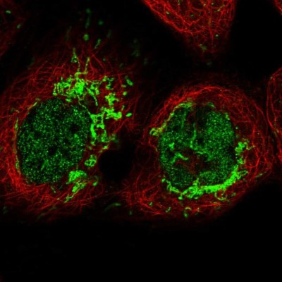 Immunocytochemistry/Immunofluorescence: MFSD12 Antibody [NBP2-47376] - Immunofluorescent staining of human cell line A-431 shows localization to nucleoplasm & mitochondria.