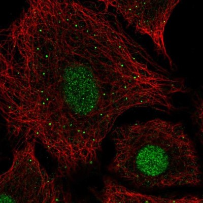 Immunocytochemistry/Immunofluorescence: USF2 Antibody [NBP2-56717] - Staining of human cell line A549 shows localization to nucleoplasm & vesicles.