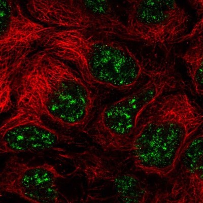 Immunocytochemistry/Immunofluorescence: ICAM-4 Antibody [NBP2-56639] - Staining of human cell line CACO-2 shows localization to nuclear speckles.