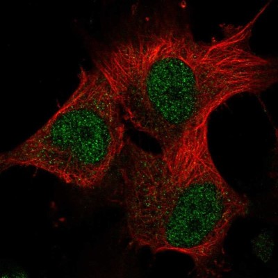 Immunocytochemistry/Immunofluorescence: METT10D Antibody [NBP2-56696] - Staining of human cell line U-251 MG shows localization to nucleoplasm.