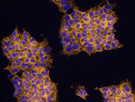PIWIL4 was detected in immersion fixed BG01V human embryonic stem cells using Human PIWIL4 Monoclonal Antibody (Catalog # MAB6316) at 10 µg/mL for 3 hours at room temperature. Cells were stained using the NorthernLights™ 557-conjugated Anti-Mouse IgG Secondary Antibody (yellow; Catalog # NL007) and counterstained with DAPI (blue). Specific staining was localized to cytoplasm. View our protocol for Fluorescent ICC Staining of Cells on Coverslips.
