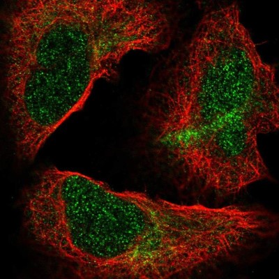 Immunocytochemistry/Immunofluorescence: Nucleoporin NUP85/Pericentrin 1 Antibody [NBP2-56709] - Staining of human cell line U-2 OS shows localization to nucleoplasm & cytosol.