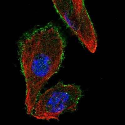 Immunocytochemistry/Immunofluorescence: JIP1 Antibody [NBP2-58545] - Staining of human cell line PC-3 shows localization to plasma membrane.