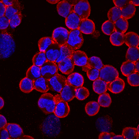 Protocadherin‑15 was detected in immersion fixed YT human leukemia natural killer‑like cell line using Mouse Anti-Human Protocadherin‑15 Monoclonal Antibody (Catalog # MAB6729) at 10 µg/mL for 3 hours at room temperature. Cells were stained using the NorthernLights™ 557-conjugated Anti-Mouse IgG Secondary Antibody (red; Catalog # NL007) and counterstained with DAPI (blue). Specific staining was localized to cytoplasm. View our protocol for Fluorescent ICC Staining of Non-adherent Cells.