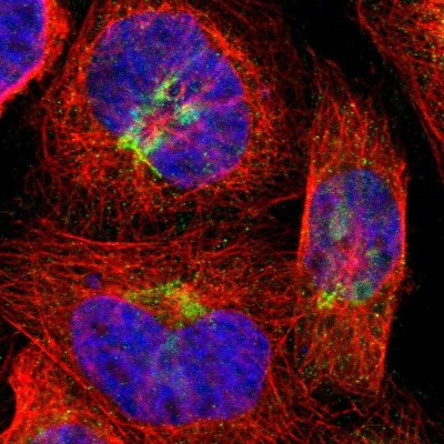 Immunocytochemistry/Immunofluorescence: CDH9 Antibody [NBP1-86498] - Staining  of human cell line A-431 shows positivity in golgi apparatus.