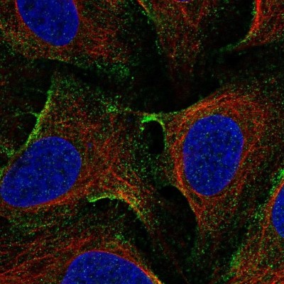 Immunocytochemistry/Immunofluorescence: EHD1 Antibody [NBP2-56035] - Staining of human cell line U-2 OS shows localization to plasma membrane.
