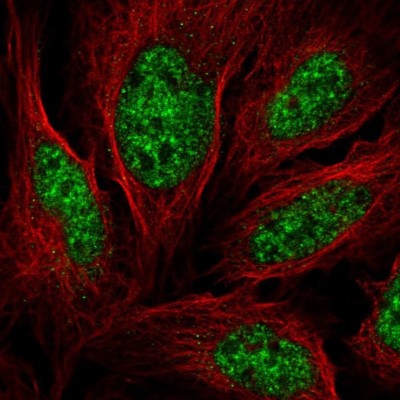 Immunocytochemistry/Immunofluorescence: Aly Antibody [NBP2-56154] - Staining of human cell line U-2 OS shows localization to nuclear speckles.