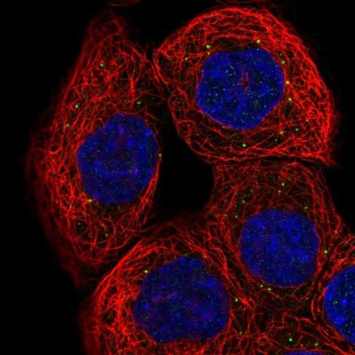 Immunocytochemistry/Immunofluorescence: RNF135 Antibody [NBP2-56223] - Staining of human cell line A-431 shows localization to vesicles.