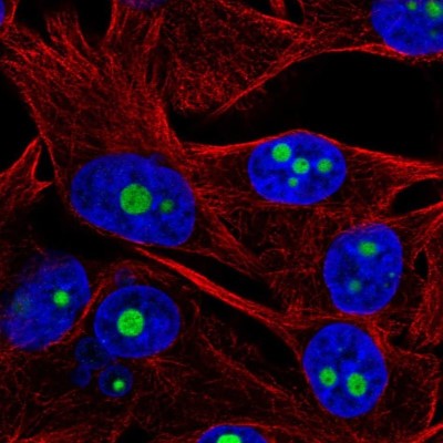 Immunocytochemistry/Immunofluorescence: ACTR10 Antibody [NBP2-55963] - Staining of human cell line SK-MEL-30 shows localization to nucleoli.