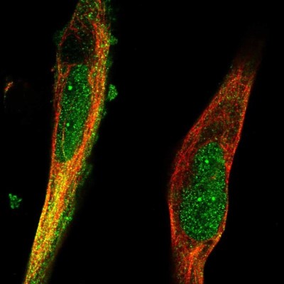 Immunocytochemistry/Immunofluorescence: RNF98 Antibody [NBP2-56200] - Staining of human cell line RH-30 shows localization to nucleus, nuclear bodies & cytosol.