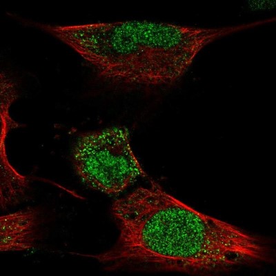Immunocytochemistry/Immunofluorescence: HOXC4 Antibody [NBP2-56195] - Staining of human cell line U-251 MG shows localization to nucleus.