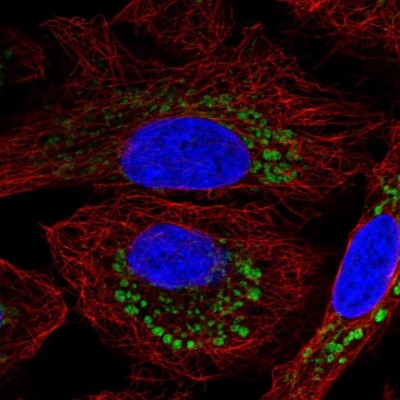 Immunocytochemistry/Immunofluorescence: DPY19L2 Antibody [NBP2-56009] - Staining of human cell line A549 shows localization to mitochondria.