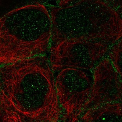 Immunocytochemistry/Immunofluorescence: OSR2 Antibody [NBP2-56333] - Staining of human cell line A-431 shows localization to nucleus & plasma membrane.
