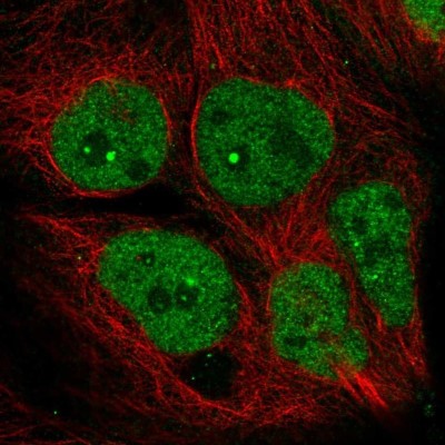 Immunocytochemistry/Immunofluorescence: AFF4 Antibody [NBP2-56715] - Staining of human cell line CACO-2 shows localization to nucleus & nucleoli fibrillar center.