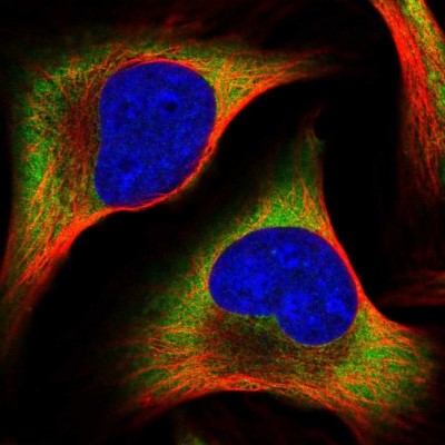 Immunocytochemistry/Immunofluorescence: PABPC4 Antibody [NBP2-58575] - Staining of human cell line U-2 OS shows localization to cytosol.