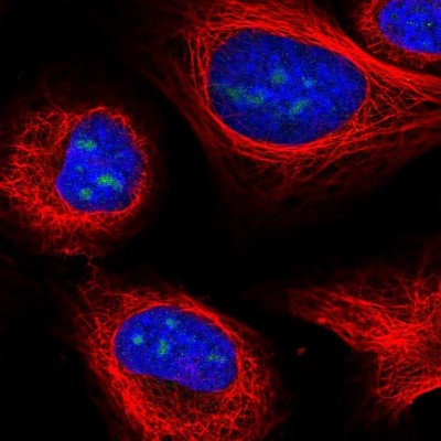 Immunocytochemistry/Immunofluorescence: UTP3 Antibody [NBP2-58960] - Staining of human cell line U-2 OS shows localization to nucleoli.