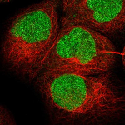 Immunocytochemistry/Immunofluorescence: BPTF/FALZ Antibody [NBP1-84756] - Immunofluorescent staining of human cell line A-431 shows localization to nucleoplasm.