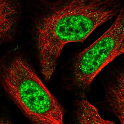 Immunocytochemistry/Immunofluorescence: RBBP6 Antibody [NBP2-47311] - Immunofluorescent staining of human cell line U-2 OS shows localization to nuclear speckles.