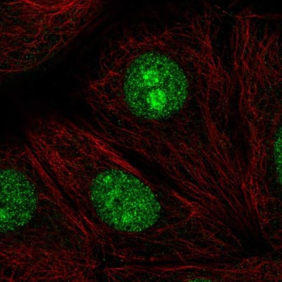 Immunocytochemistry/Immunofluorescence: SENP3 Antibody [NBP2-32525] - Staining of human cell line MCF7 shows localization to nucleus & nucleoli.