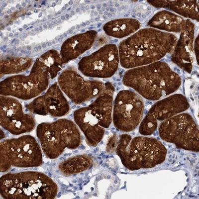 Immunohistochemistry-Paraffin: C15orf39 Antibody [NBP1-90552] - Staining of human kidney shows strong cytoplasmic positivity in tubule cells.