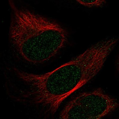 Immunocytochemistry/Immunofluorescence: NUDT7 Antibody [NBP1-91125] - Staining of human cell line U-2 OS shows positivity in nucleus but not nucleoli.
