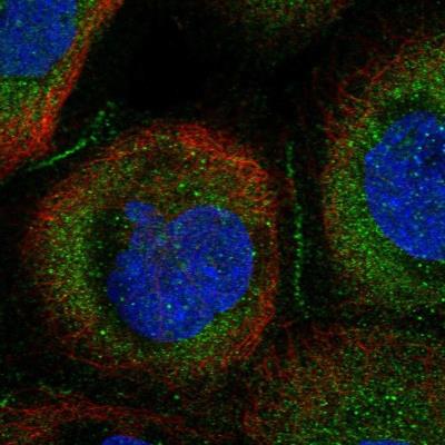 Immunocytochemistry/Immunofluorescence: CCDC66 Antibody [NBP1-91761] - Staining of human cell line A-431 shows positivity in cytoplasm and cell junctions.