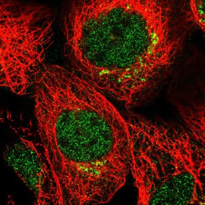 Immunocytochemistry/Immunofluorescence: MDFIC Antibody [NBP1-93698] - Immunofluorescent staining of human cell line A-431 shows localization to nucleoplasm & the Golgi apparatus.