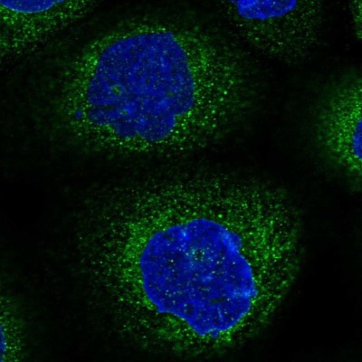 Immunocytochemistry/Immunofluorescence: NEDL2 Antibody [NBP1-92174] - Staining of human cell line A-431 shows localization to endoplasmic reticulum.
