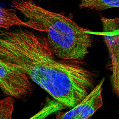 Immunocytochemistry/Immunofluorescence: TOM1L2 Antibody [NBP1-86414] - Immunofluorescent staining of human cell line U-251 MG shows localization to intermediate filaments.