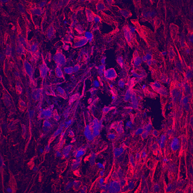 Matrilin-1 was detected in immersion fixed human mesenchymal stem cells differentiated into chondrocytes using Mouse Anti-Human Matrilin-1 Monoclonal Antibody (Catalog # MAB7878) at 10 µg/mL for 3 hours at room temperature. Cells were stained using the NorthernLights™ 557-conjugated Anti-Mouse IgG Secondary Antibody (red; Catalog # NL007) and counterstained with DAPI (blue). Specific staining was localized to cartilage matrix. View our protocol for Fluorescent ICC Staining of Cells on Coverslips.