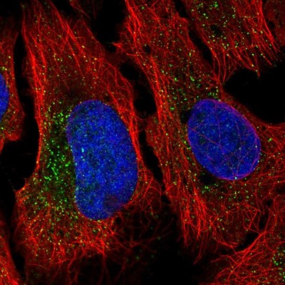 Immunocytochemistry/Immunofluorescence: NHE6/SLC9A6 Antibody [NBP2-38877] - Immunofluorescent staining of human cell line U-2 OS shows localization to vesicles.
