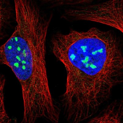 Immunocytochemistry/Immunofluorescence: MPHOSPH10 Antibody [NBP2-38232] - Immunofluorescent staining of human cell line U-2 OS shows localization to nucleoli.