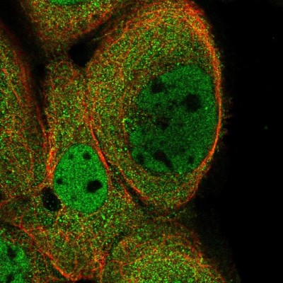 Immunocytochemistry/Immunofluorescence: Kinesin C2 Antibody [NBP1-87535] - Immunofluorescent staining of human cell line A-431 shows localization to nucleoplasm & cytosol.