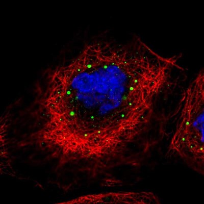 Immunocytochemistry/Immunofluorescence: HLA DPA Antibody [NBP1-89689] - Staining of human cell line A-431 shows positivity in vesicles.