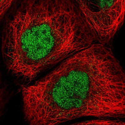 Immunocytochemistry/Immunofluorescence: GLB1L2 Antibody [NBP2-31585] - Immunofluorescent staining of human cell line A-431 shows localization to nucleoplasm.
