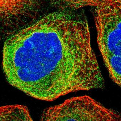 Immunocytochemistry/Immunofluorescence: CDS2 Antibody [NBP1-86435] - Immunofluorescent staining of human cell line A-431 shows localization to endoplasmic reticulum.