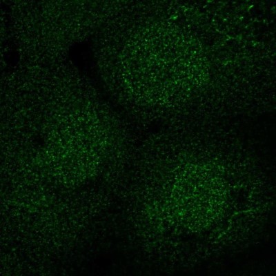Immunocytochemistry/Immunofluorescence: SEC14L2 Antibody [NBP2-39029] - Staining of human cell line A-431 shows localization to nucleus & cytosol.