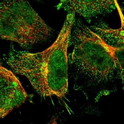 Immunocytochemistry/Immunofluorescence: RGL1 Antibody [NBP1-87136] - Immunofluorescent staining of human cell line U-251 MG shows localization to nucleoplasm, the Golgi apparatus & vesicles.