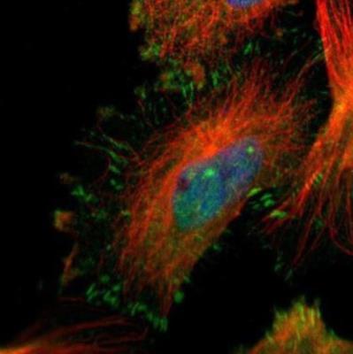 Immunocytochemistry/Immunofluorescence: MYH7 Antibody [NBP2-52737] - Staining of human cell line U-251MG shows positivity in nucleus but not nucleoli, cytoplasm & focal adhesions.