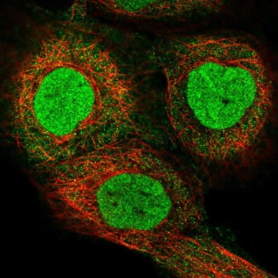 Immunocytochemistry/Immunofluorescence: TOP2B Antibody [NBP2-58728] - Staining of human cell line A-431 shows localization to nucleus & cytosol.