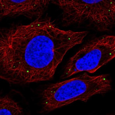 Immunocytochemistry/Immunofluorescence: xCT Antibody [NBP2-56446] - Staining of human cell line U-2 OS shows localization to vesicles.