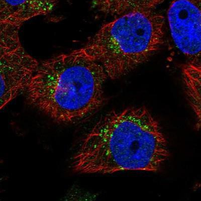 Immunocytochemistry/Immunofluorescence: TNPO3 Antibody [NBP1-81585] - Staining of human cell line U-251 MG shows positivity in vesicles.