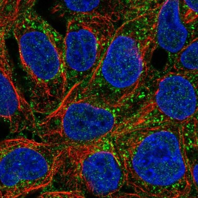 Immunocytochemistry/Immunofluorescence: PAG1 Antibody [NBP2-56541] - Staining of human cell line RT4 shows localization to plasma membrane & vesicles.