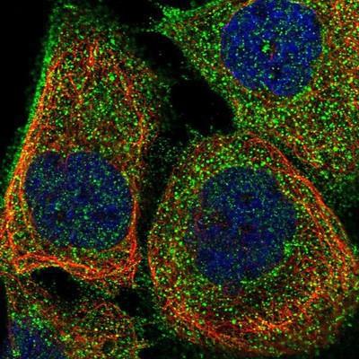 Immunocytochemistry/Immunofluorescence: HCLS1 Antibody [NBP1-85380] - Staining of human cell line A-431 shows positivity in plasma membrane and cytoplasm.