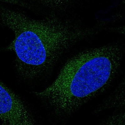 Immunocytochemistry/Immunofluorescence: CYP51A1 Antibody [NBP2-48793] - Immunofluorescent staining of human cell line U-2 OS shows localization to endoplasmic reticulum.