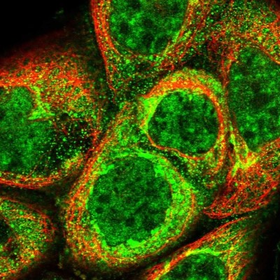 Immunocytochemistry/Immunofluorescence: C19orf24 Antibody [NBP1-83638] - Staining of human cell line A-431 shows localization to nuclear speckles & the Golgi apparatus.