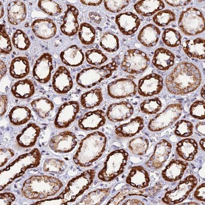 Immunohistochemistry-Paraffin: C19orf24 Antibody [NBP1-83638] - Staining of human kidney shows strong cytoplasmic positivity in renal tubules.