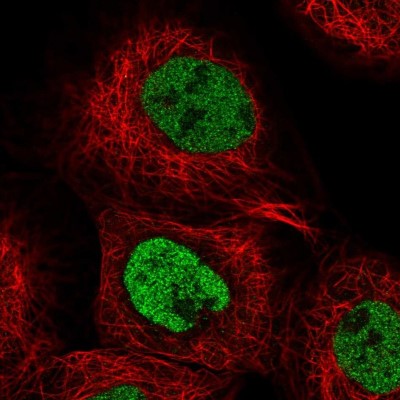 Immunocytochemistry/Immunofluorescence: EYA3 Antibody [NBP2-47464] - Immunofluorescent staining of human cell line A-431 shows localization to nucleoplasm.