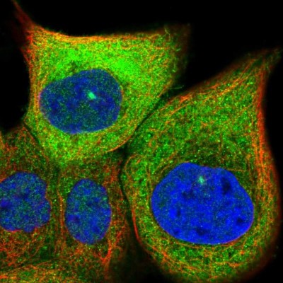 Immunocytochemistry/Immunofluorescence: TACC3 Antibody [NBP1-84810] - Immunofluorescent staining of human cell line A-431 shows localization to cytosol & centrosome.